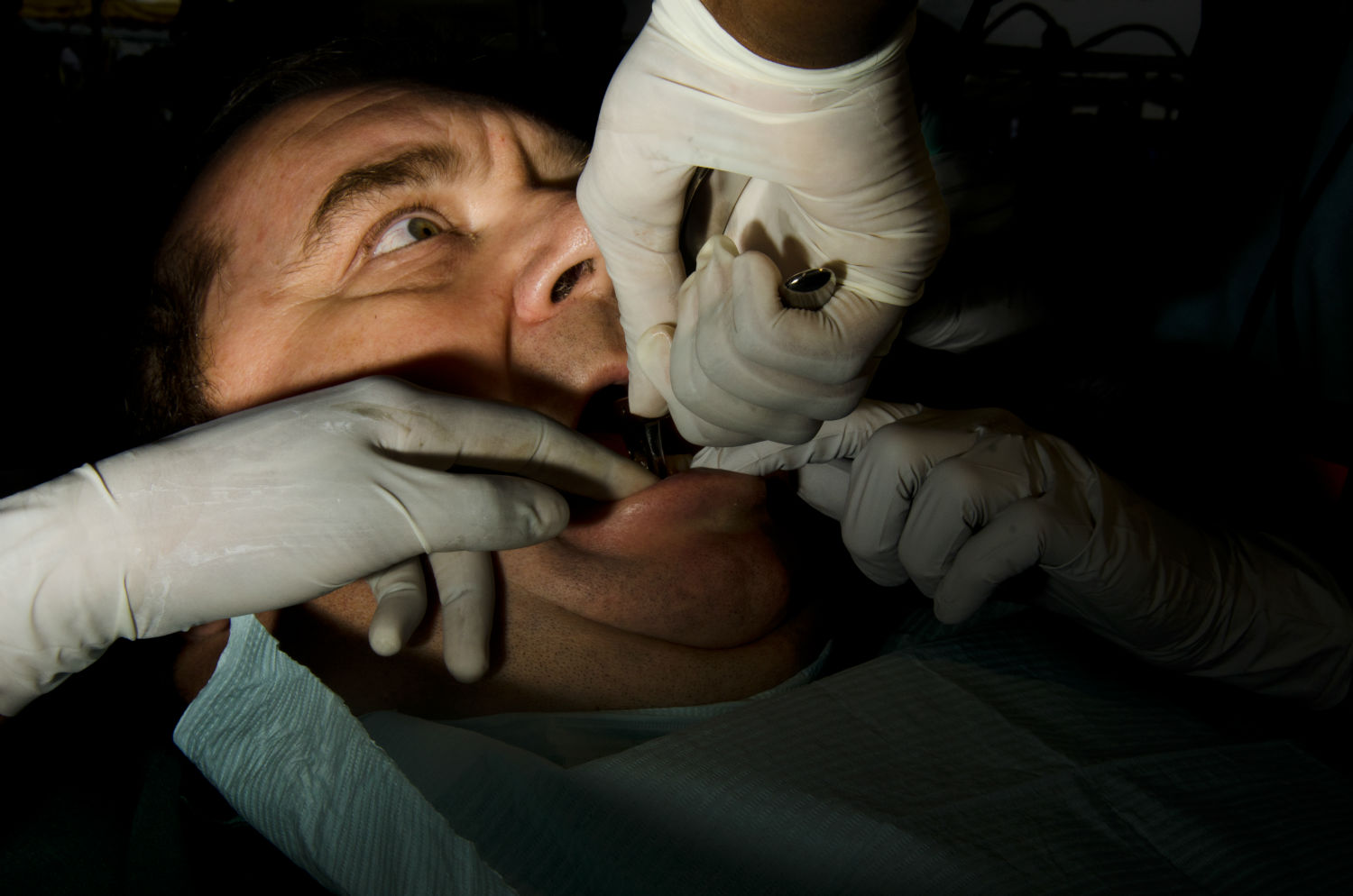 "Each year in July the Rural Area Medical unit sets up an expansive outdoor dental office. They provide free healthcare to people without insurance. There is a lot of teeth pulling."